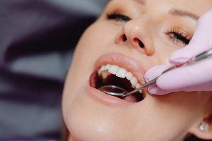 Síntomas de una corona dental mal colocada y qué debes hacer