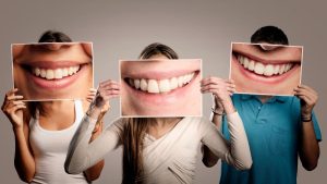 ¿Quién puede tener implantes dentales?