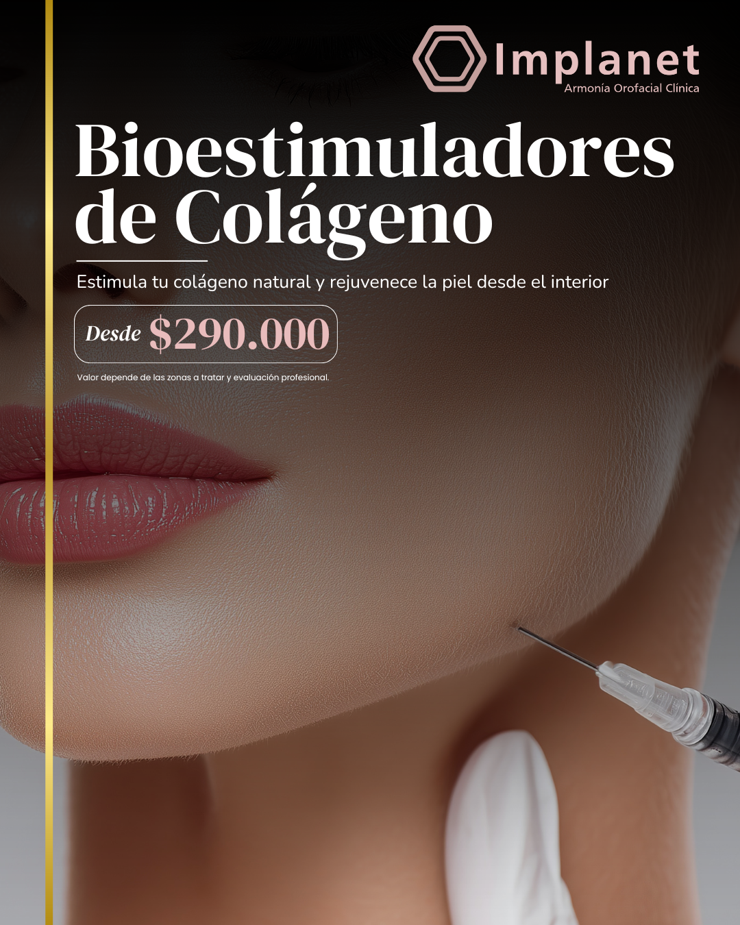 Bioestimuladores de Colágeno