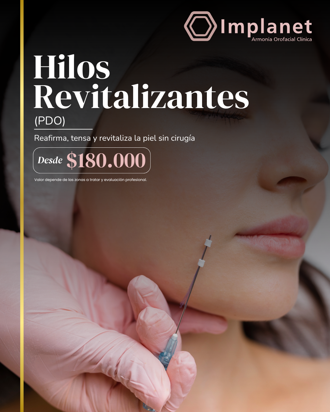 Hilos PDO