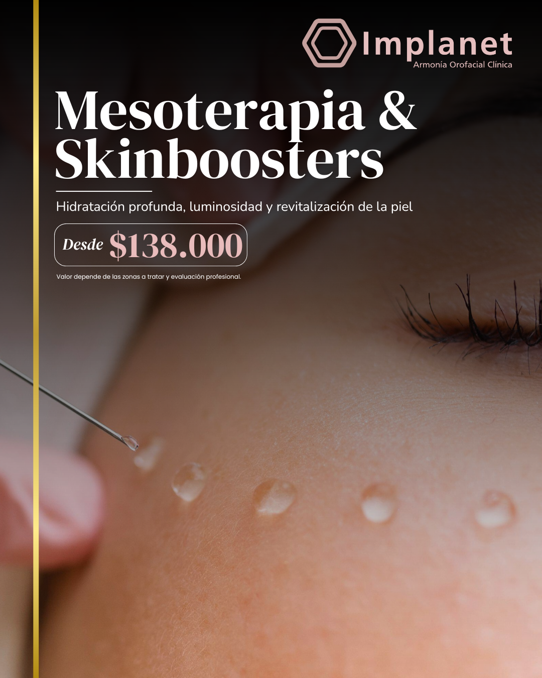 Mesoterapia & Skinboosters